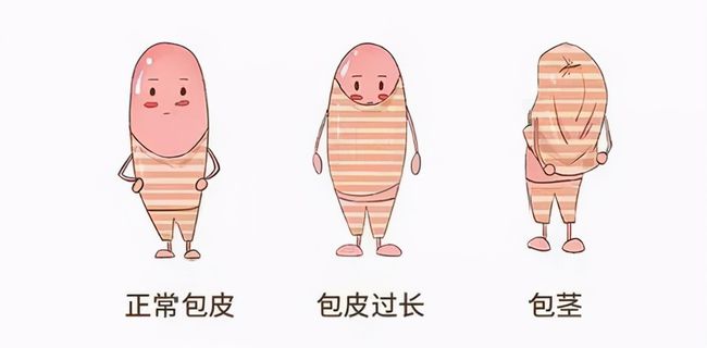 儿童包皮一定要切吗,完美体育·(中国)官方网站